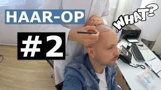 Am Tag der Operation  Vlog  Meine 2 Haartransplantation – Grey Young [upl. by Isola]