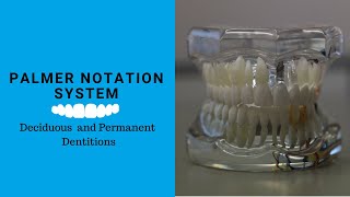 Palmer tooth Notation System  Tooth notation system [upl. by Hadihsar]