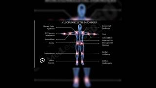 MUSCLE SKELETAL Disorder About quotBALARISTAquotAyurbalam [upl. by Ajile]