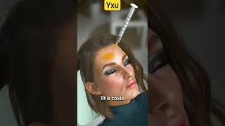 Yxu beauty botox skincare botoxtreatment eyebrows botoxcosmetic doctor botoxoakville eyes [upl. by Samaj]