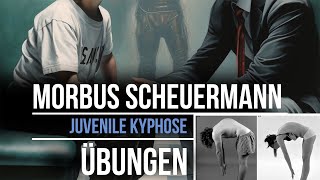 Übungen Morbus Scheuermann  Juvenile Kyphose  Rundrücken [upl. by Seuguh]