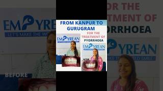 Permanent treatment of Pyorrhoea shorts viralvideo trending gumdisease pyorrhea smilemakeover [upl. by Aletse]