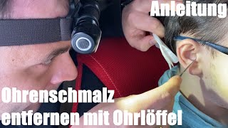 Ohrenschmalz entfernen mit Ohrlöffel  Ohrenschlinge benutzen zur Reinigung Anleitung [upl. by Aruasor698]