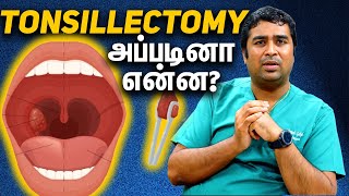 Understanding Tonsillectomy with Dr Vignesh Gokul  Expert ENT Explains in Tamil [upl. by Navak215]