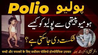 Polio پولیو पोलियो Homeopathic Treatment In Urdu  Hindi [upl. by Nyrak490]