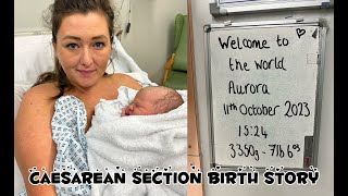 FULL CAESAREAN SECTION BIRTH STORY WITH QUESTIONS ANSWERED [upl. by Ardni]