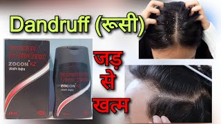 Zocon KZ shampoo uses  Ketoconazole shampoo use in hind  Dandruff treatment in hindi रूसी से राहत [upl. by Sands102]