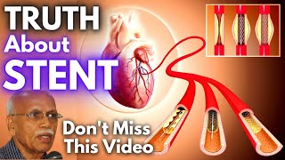 Does STENT Really Work To Save From Heart Attack  Dr B M Hegde [upl. by Atinej]