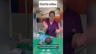 Startle reflex in newborn  moro’s reflex  baby doctor newborn babyvideos shorts cutebaby [upl. by Idnar]