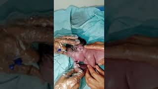 When cleaning process newborn how recovery newborn baby thanks to God wnd of video he is crying [upl. by Eniluqcaj126]