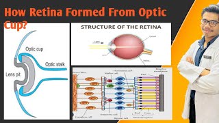 Development of Retina and Cornea  Why Is Retina Neuroectodermal in Origin [upl. by Hseyaj773]