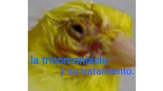 tricomoniasismi experiencia [upl. by Aiket]