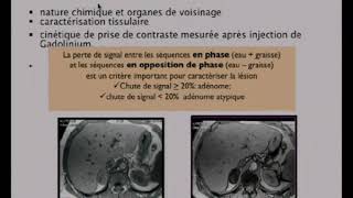 Quel bilan quelle prise en charge thérapeutique [upl. by Worra363]