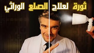 فيناسترايد لعلاج الصلع بلا اضرار؟ و علاج اقوى مفاجئة 💡 [upl. by Millur746]