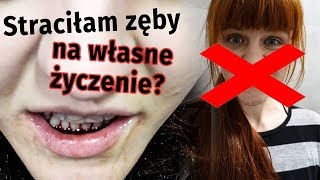 Jak straciłam zęby 😱 NOWY ROK NOWA TWARZ [upl. by Orlantha]