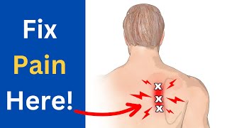 How To Get Rid Of Rhomboid Pain  Lasting Relief [upl. by Nikral]