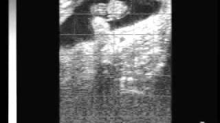 Bovine pregnancy 40 days with EasiScan ultrasoundwmv [upl. by Eecats]