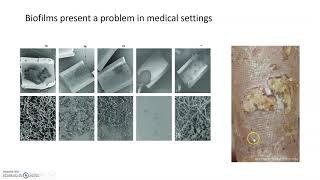 BIOFILM FORMATION [upl. by Ginzburg925]