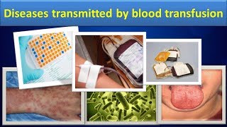 Diseases transmitted by blood transfusionClear over view [upl. by Ier]