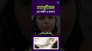 হারসুটিজম এর লক্ষণ এবং কারণসমুহ । Hirsutism [upl. by Latton]