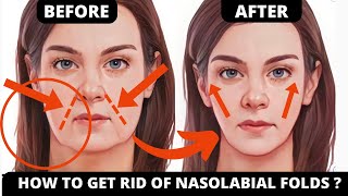 HOW TO GET RID OF NASAL FOLDS LINES  GET RID OF FROWN LINES DOUBLE CHIN [upl. by Smalley]