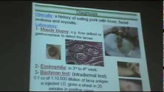 DrAzza Parasitology  Nematodes 6  Tissue Nematodes [upl. by Heisser]