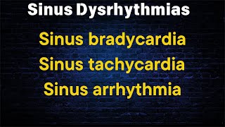 Sinus Dysrhythmias  Sinus bradycardia  Sinus tachycardia  Sinus arrhythmia [upl. by Ormond]