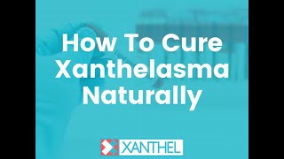 How To Cure Xanthelasma Naturally  Brought To You By XANTHEL ® Easy Xanthelasma Removal [upl. by Pollie982]