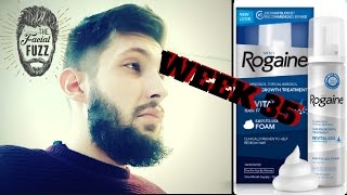 Minoxidil Beard  8 MONTHS  Week 35  Minoxidil 5 for Beard Growth  Facialfuzzfridays [upl. by Jamima55]