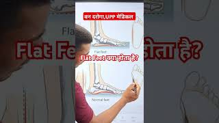 Flat Feet Kya Hota hai  UPSSSC Van Daroga UPP Medical Test  medical flatfeet [upl. by Airt]