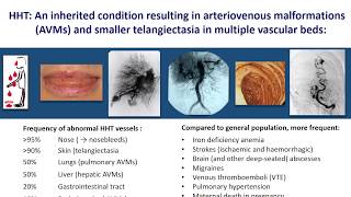 An Overview of Hereditary Haemorrhagic Telangiectasia HHT by Prof Claire Shovlin [upl. by Anaynek]