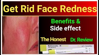 How to use betnovate n cream  benefits and side effects  Dr review betnovate cream [upl. by Hamrah]