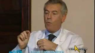 Dott Guidi  Bypass e Angioplastica  cardioexpertit [upl. by Stearne190]