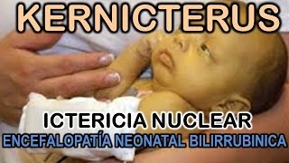 KERNICTERUS  ICTERICIA NUCLEAR  ENCEFALOPATÍA NEONATAL BILIRRUBINICA [upl. by Teemus291]