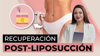 Liposucción Claves para EVITAR la FIBROSIS y prolongar los resultados [upl. by Ardnnek]