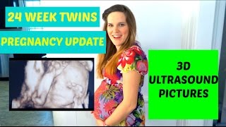 24 WEEK TWINS PREGNANCY UPDATE 3D ULTRASOUND PICTURES [upl. by Dorotea]