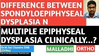 DIFF BETWEEN SPONDYLOEPIPHYSEAL AND MULTIPLE EPIPHYSEAL DYSPLASIA [upl. by Rhoades]