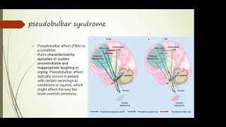 19 Bulbar and pseudobulbar syndrome topical and differential diagnostics [upl. by Aietal770]