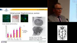 GSK Vaccines Award 20102012 Presentation by Dr Claus Bachert [upl. by Nwahsyar]