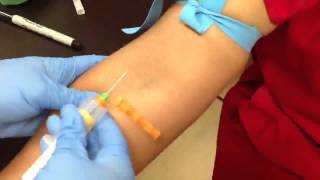 Venipuncture 13 [upl. by Hanae]