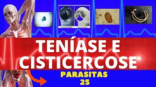 TENÍASE E CISTICERCOSE  TÊNIA SOLIUM E TÊNIA SARGINATA SOLITÁRIA  PARASITOLOGIA  INFECTOLOGIA [upl. by Eillac]