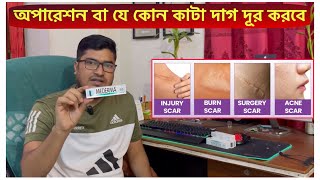 Mederma Advanced Scar Removal Gel  সার্জারির দাগ দ্রুতগতিতে দূর করে যে ক্রিম  Scar Removal Cream [upl. by Smaj]