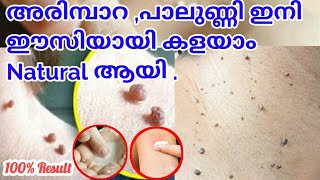 100 Effective അരിമ്പാറ വേരോടെ മാറുംarimpara removal malayalamhow to remove skin tags malayalam [upl. by Nuawd300]