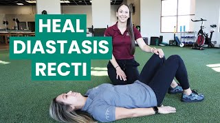 Exercises to Fix Your Diastasis Recti  Physical Therapy [upl. by Macomber874]