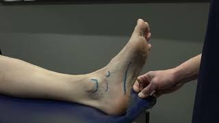 Foot and Ankle 2  Plantar Fascia and Spring Ligament Palpation [upl. by Hareehat281]