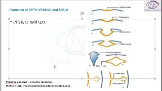 Lec 5 Formation of OPTIC VESICLE and STALK mp4  OPHTHALMOLOGY [upl. by Anum]