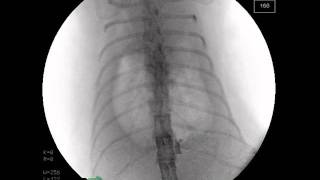 Cat with pleural effusion  hydrothorax  Fluorscopy wiev xray [upl. by Ailedamla142]