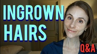 Ingrown hairs how to get rid of them amp skin care tips Dr Dray [upl. by Thurston982]