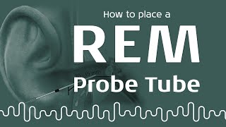 REM Probe Tube Placement Methods [upl. by Ynettirb551]