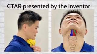 Dysphagia Swallowing Exercise  Chin Tuck Against Resistance with Ball by CTAR Inventor English [upl. by Housum]